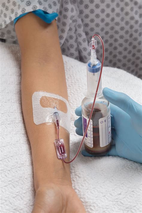 Blood Culture Collection From A Peripheral Iv Catheter Kurin