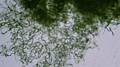 Premium stock video - Green algae cells in microscope bright field