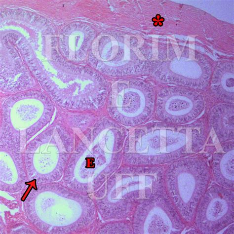 Sistema Genital Atlas Virtual De Histologia