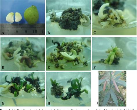 Figure 1 From Somatic Embryogenesis And Plantlet Regeneration Of