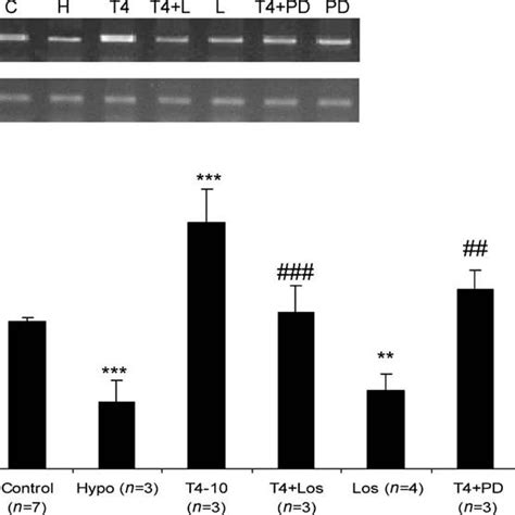 Tgf β1 Mrna Expression As Shown By The Tgf β1 Mrnaβ Actin Mrna Ratio