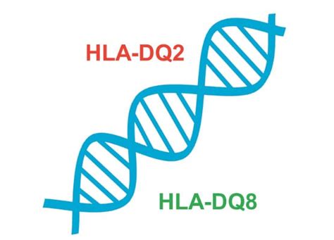 Badanie W Kierunku Celiakii Geny Hla Dq2 I Dq8 Cena Zdrowegenypl