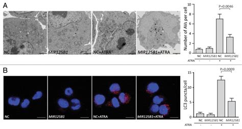 Mir B Represses The Degradation Of The Pml Rara Oncoprotein By An