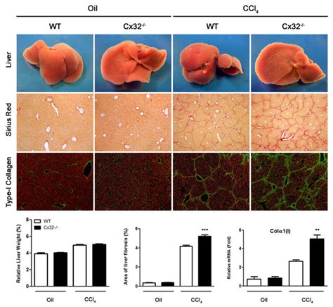 Loss Of Cx32 Enhances Liver Fibrosis After CCl 4 Induced Chronic Liver