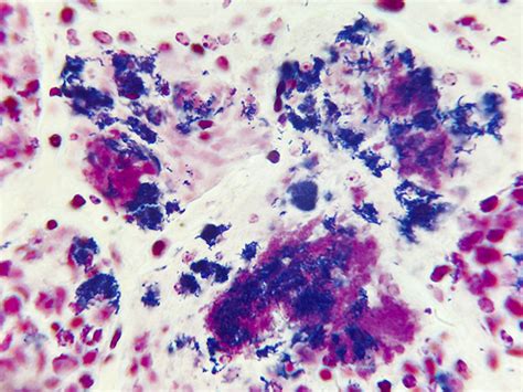 Gram Positive & Gram Negative Bacteria Histology Slides, Animal