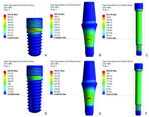 Equivalent Stress Distributions Of The Implant Abutment And Abutment Download Scientific