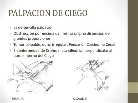 Semiologia Abdominal Ppt