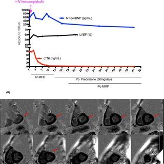 A The Dynamic Changes In Cardiac Troponin Level Ntprobnp Level And