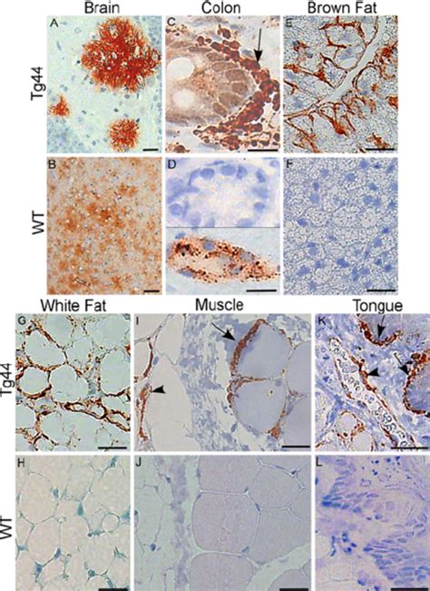 Immunohistochemical Detection Of Prpres In Tissues Of L Infected Tg