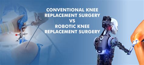 Conventional Vs Robotic Knee Replacement Surgery Amandeep Hospital