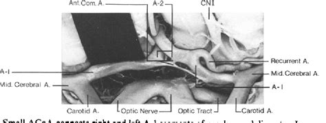 Figure From Microsurgical Anatomy Of Anterior Cerebral Anterior