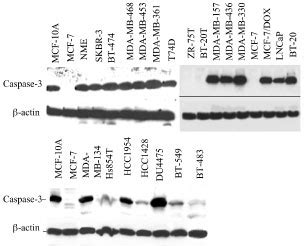 Levels Of Caspase Protein Expression In Various Breast Cancer Cell