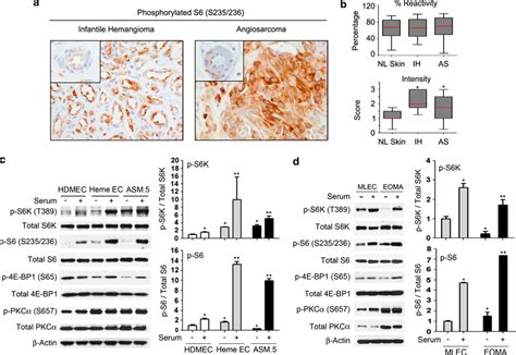 Vascular Tumors Have Increased P70 S6 Kinase Activation And Are