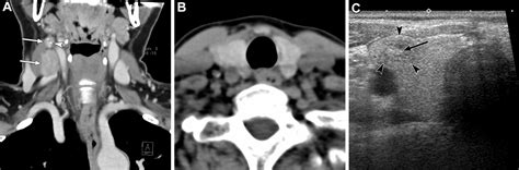 Imaging Approach For Cervical Lymph Node Metastases From Unknown