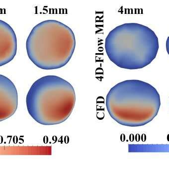 Averaged Systolic And Diastolic Velocity Magnitude Ms Contours