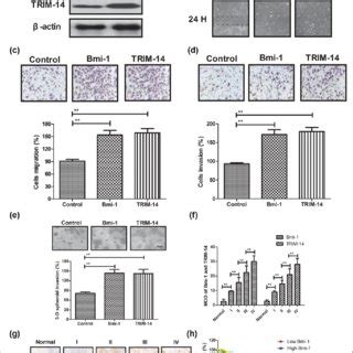 Bmi 1 And TRIM 14 Expression In Bone Cancer Cells And Clinical Tissues