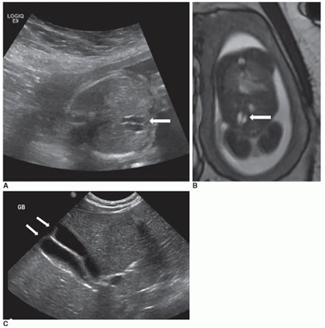 The Pediatric Abdomen Radiology Key