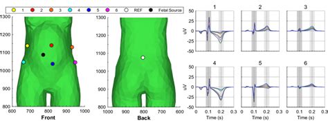 Simulated Ni Fecg Waveforms For The Homogeneous And Asymmetric Volume Download Scientific