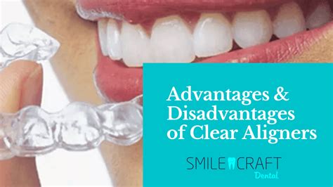 Advantages Disadvantages Of Clear Aligners