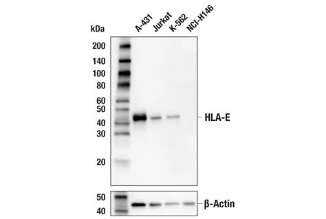 Hla E Mem E02 Mouse Mab Cell Signaling Technology