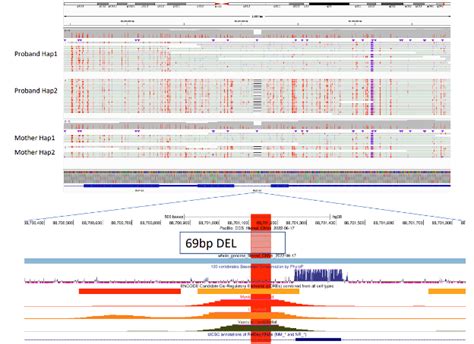 The HiFi Difference Out Of The Box 5 Base Sequencing PacBio