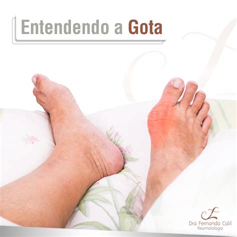 Entendendo A Gota