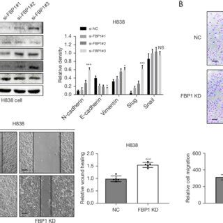 Knockdown Of Fbp Promotes Epithelial Mesenchymal Transformation A