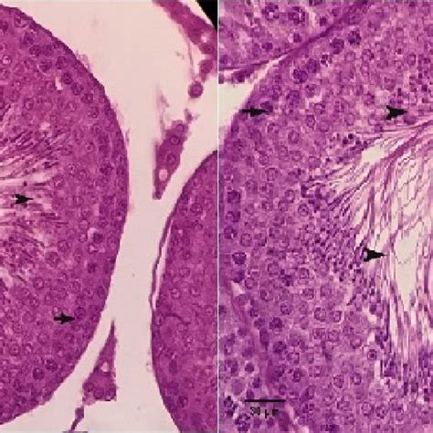 Testis Section Of Left Testis In Ir Rats Showing Degenerated