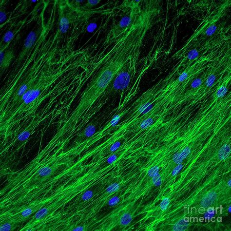 Dermal Fibroblast Cells Photograph by Daniel Schroen, Cell Applications ...