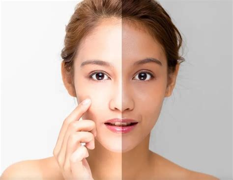 Fish Oil Benefits For Skin Whitening Reduce Acne And More