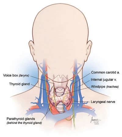 Parathyroid adenoma surgery | parathyroidectomy