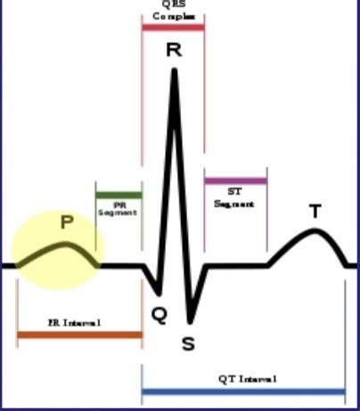 Ecg Waveforms And Intervals Chapter Flashcards Quizlet