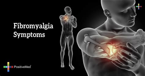 Fibromyalgia Symptoms