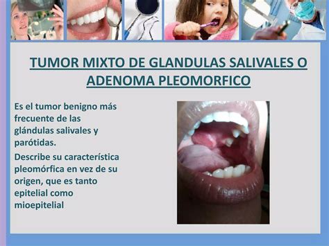 Lesiones De La Cavidad Oral PPT Descarga Gratuita