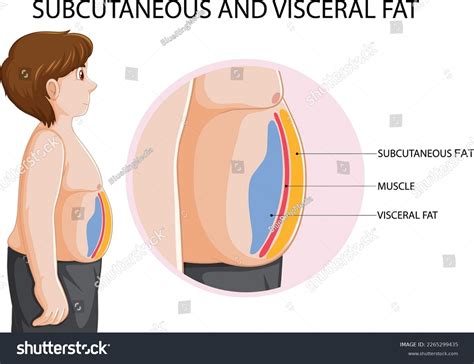 474 Belly Fat Diagram Images, Stock Photos & Vectors | Shutterstock