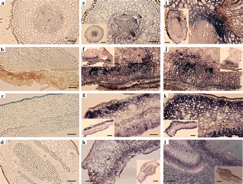 Tissue Distributions Of Citrus Exocortis Viroid CEVd And Hop Stunt