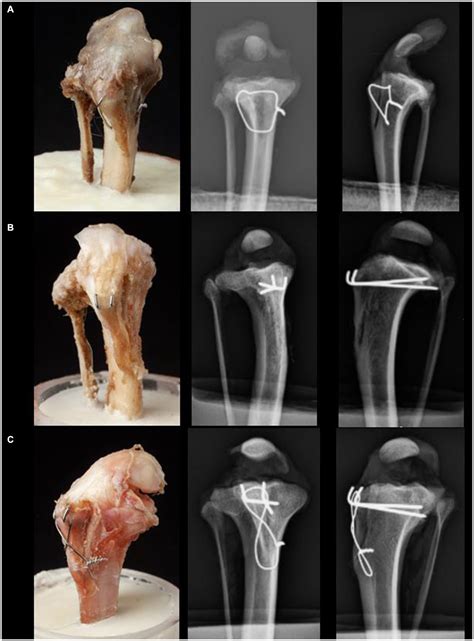 Frontiers Biomechanical Evaluation Of A Fixation Technique With A