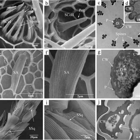 Scanning And Transmission Electron Micrographs Of Sensilla Trichodea