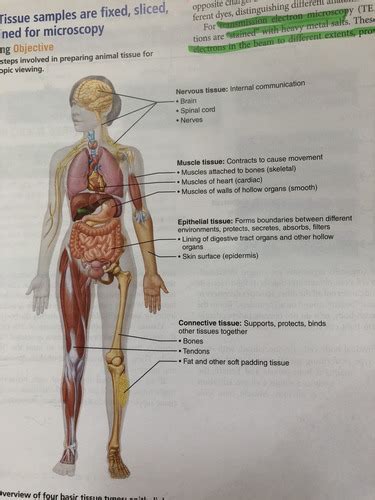 Exam Diagrams Flashcards Quizlet