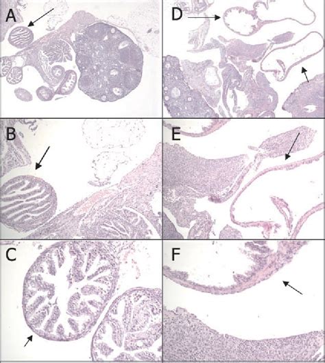 Figure 1 From Tract Infection Oviduct Pathology In Chlamydial Genital