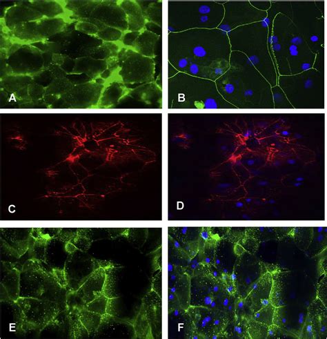 Immunohistochemical Analysis For Tight Junction Proteins In The D Hce