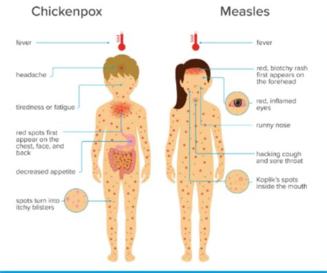 Infectious Disease Immunizations Flashcards Quizlet