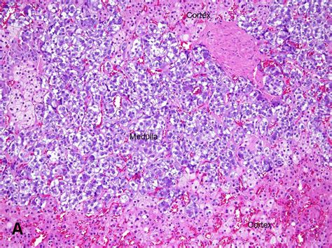 Histology Of Adrenal Medulla Hot Sex Picture