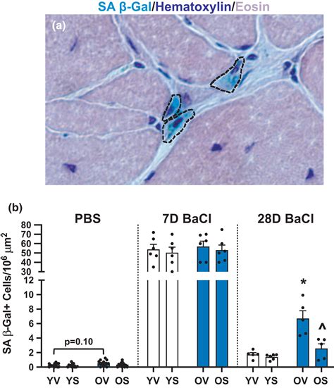 Deletion of SA βGal cells using senolytics improves muscle