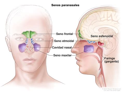 Cáncer de seno paranasal y de cavidad nasal en adultos NCI