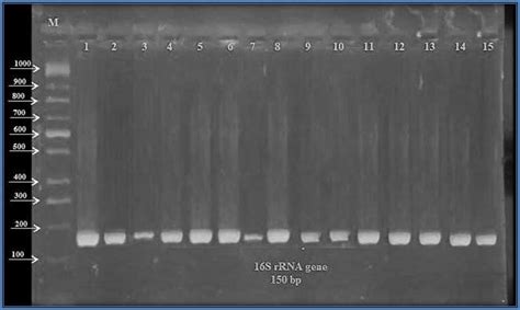 Amplification Of 16s Rrna Gene With 150 Bp On Agarose Gel Of 2 With 70