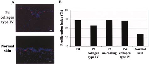 Expression Of Ki 67 In Normal Skin And In Skin Equivalents A The Download Scientific Diagram