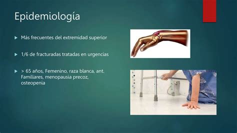 Fracturas Del Radio Distal Totalpptx