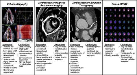 Past Present And Future Of Radiation Induced Cardiotoxicity