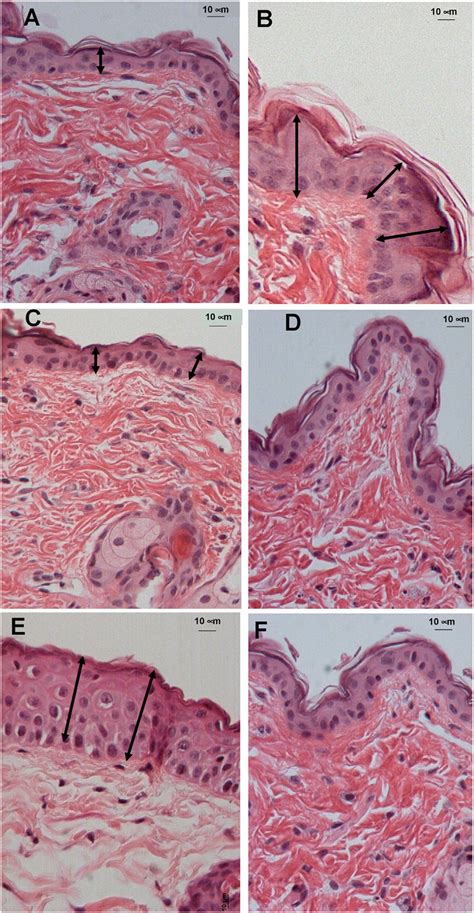 Histological Analysis Of Ne Plus Inhibitor Treated Skins Download